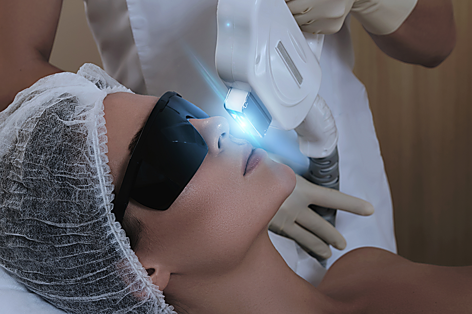 épilation laser visage risques